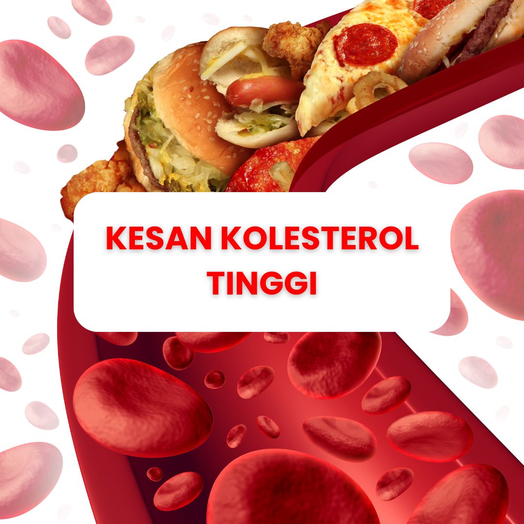 kesan kolesterol tinggi